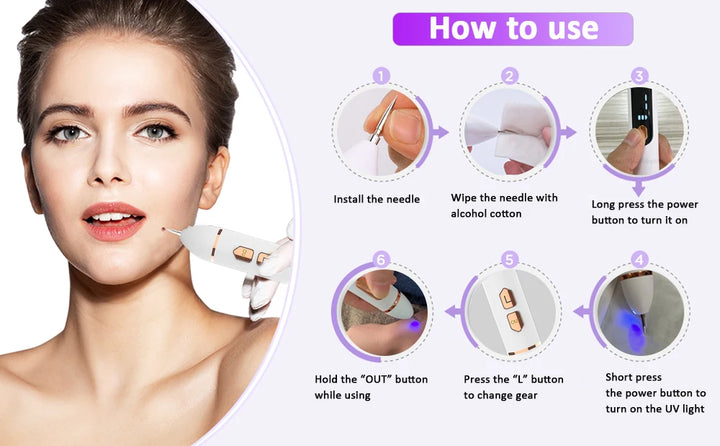 Laser Plasma Pen Black Dots Freckles Mole Wart Remover Pen Dark Spot Remover For Face Electric Pimples Tattoo Skin Tag Removal