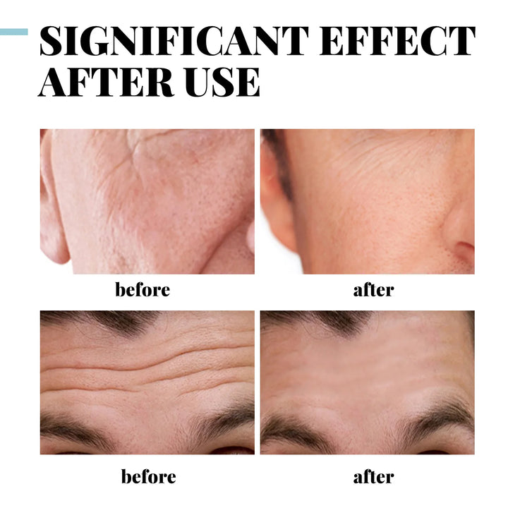 EELHOE Vitamin E Moisturizing Cream Man Improve Rough Dry Skin Tightening Nourishing Retinol Rejuvenate the Face Cream Man 50g